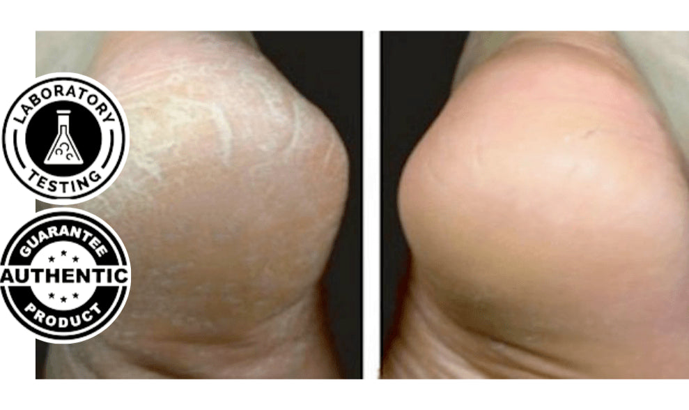 Lively® Cosmétiques & Soins Blanc Pédicure électrique | Lively®